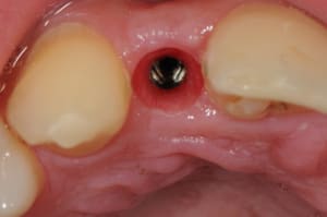 Dsc 5681 kjnwwu - Eugenol