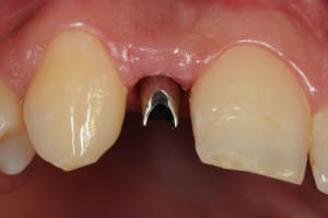 Dsc 5682 ehrpic - Eugenol
