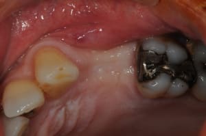 Dsc 5793 dvyyyw - Eugenol