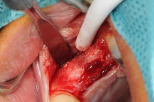 Dsc 5795 sy3um7 - Eugenol