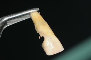 Dsc 5805 sfxatr - Eugenol