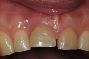 Dsc 5866 e0spxf - Eugenol