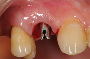 Dsc 5948 aewf6c - Eugenol