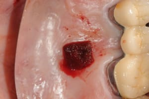 Dsc 6004 ptnxgm - Eugenol