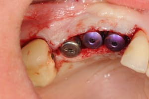 Dsc 6033 wqa5rz - Eugenol