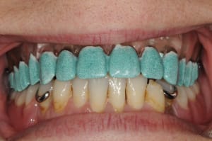 Dsc 6077 ukfhsf - Eugenol