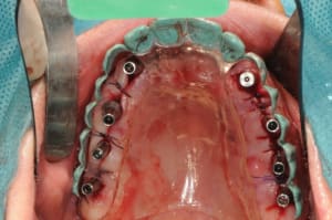 Dsc 6339 rsxhzk - Eugenol