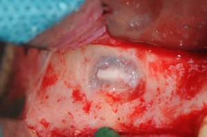 Dsc 6411 yzw55t - Eugenol