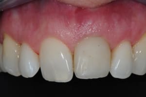 Dsc 6520 f6pqxq - Eugenol