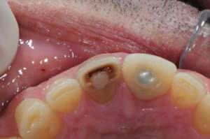 Dsc 6987 r33xaa - Eugenol