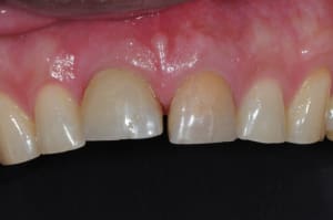 Dsc 6989 efjxtr - Eugenol