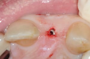 Dsc 7337 flasw0 - Eugenol