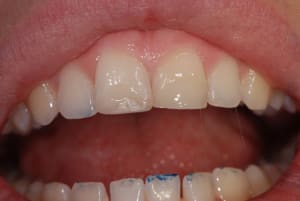 Dsc 8172s ofleeg - Eugenol