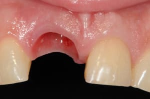 Dsc 8173 tcektw - Eugenol