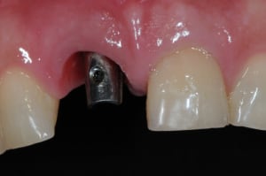Dsc 8366 b382jp - Eugenol