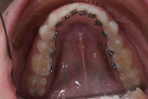 Dsc 9236 wfmy8z - Eugenol