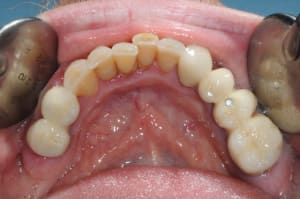 Dsc 9420 mzjykm - Eugenol