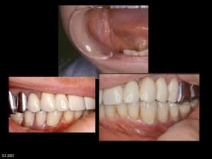 Diapositive13 zzj0vy - Eugenol