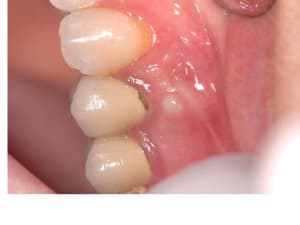 Diapositive1 fikgpk - Eugenol