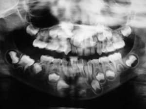Dscf0619 mxyfrx - Eugenol