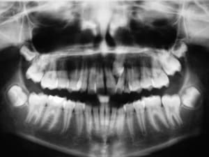 Dscf1337 vqh23h - Eugenol