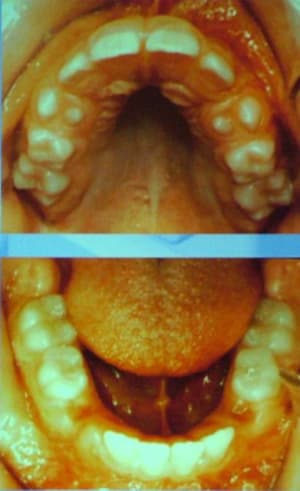 Dscf1711 hvyas3 - Eugenol