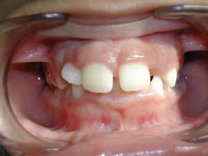 Dscn1902 ox0s4w - Eugenol