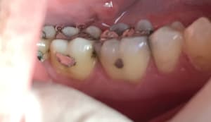 E0d5a3fc 9669 4ba1 ad33 49f87e5f97af ybmnhh - Eugenol