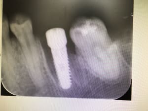 E331d1a5 04f6 4c4d 95f6 7eb3ab9b8bcb rar5kz - Eugenol