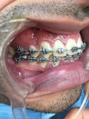 Ee2354f7 ec0b 433d 8a04 c9ae24387c04 bkm8ld - Eugenol