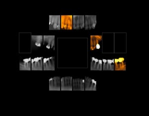 F1 cpg ancmdj - Eugenol