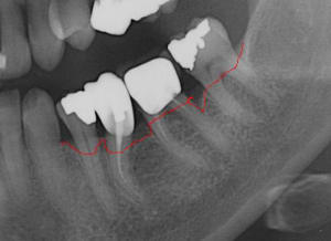 Fa elis05.04 - Eugenol