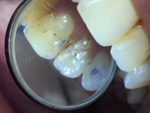 Fullsizerender 2  tftyrx - Eugenol