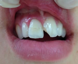 Fullsizerender  1  fcy9l7 - Eugenol