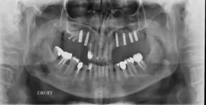 Gar mad06.11 - Eugenol