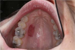 Gec7 gblyp4 - Eugenol