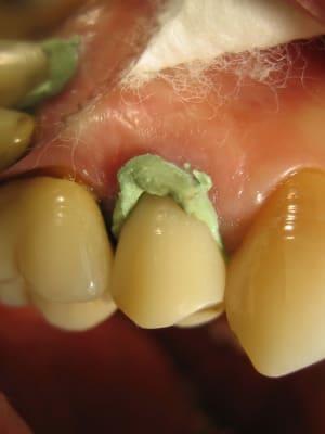 H b atrice 15  1 rrqoux - Eugenol