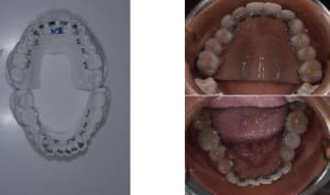 Hautbas cm2kuc - Eugenol