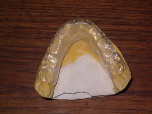 Imgp0642 nkl2vf - Eugenol