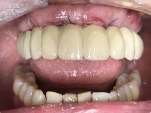 Img 0005 pwbmhm - Eugenol