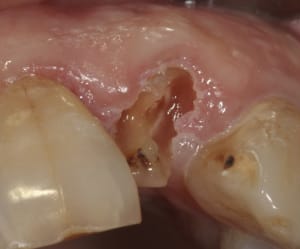 Img 0007 ufuvj8 - Eugenol