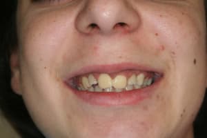 Img 0042 acdvwi - Eugenol