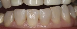 Img 0114   version 2 cr4wfn - Eugenol
