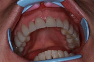 Img 0189 tkdaxy - Eugenol