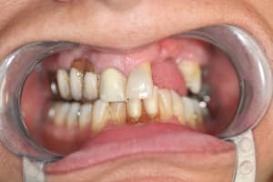 Img 0226 iaoqtw - Eugenol