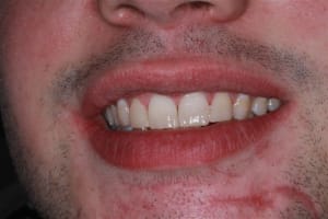 Img 0269 slpie2 - Eugenol