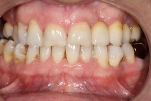 Img 0273 mpwm9h - Eugenol