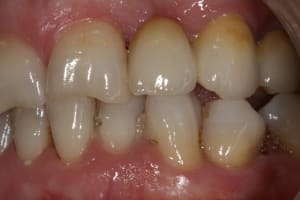 Img 0274 iyirg1 - Eugenol