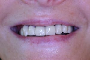 Img 0316 i5bf7m - Eugenol