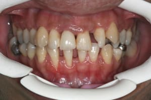 Img 0382 vv9xkf - Eugenol